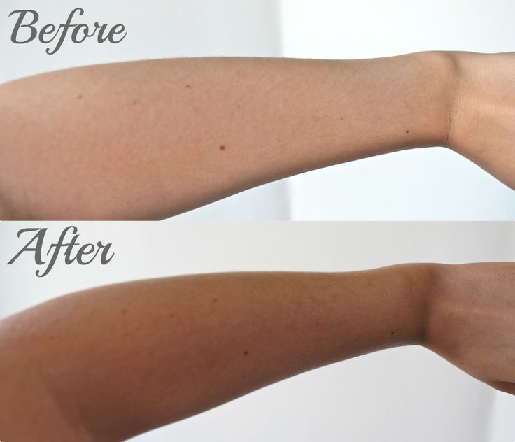 Kojic Acid Soap Pack of 2